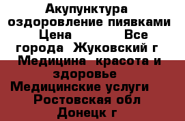 Акупунктура, оздоровление пиявками › Цена ­ 3 000 - Все города, Жуковский г. Медицина, красота и здоровье » Медицинские услуги   . Ростовская обл.,Донецк г.